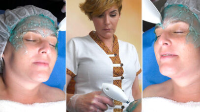 REACTION-FACIAL-redimensionada
